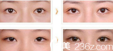 徐在敦整形外科案例