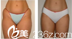 徐在敦整形外科案例