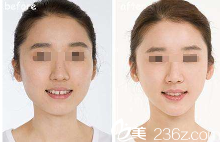 韓國(guó)在敦整形外科案例