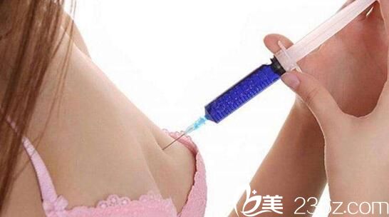 韓國(guó)iWell愛我整形外科醫(yī)院小針隆胸 韓國(guó)iWell愛我整形外科醫(yī)院小針隆胸