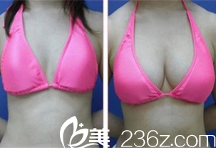 韓國(guó)在敦整形外科案例