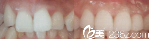 韓國face-line整形醫(yī)院