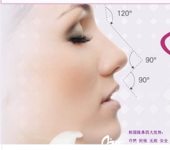 韓國(guó)iWell愛(ài)我整形外科醫(yī)院韓式隆鼻 韓國(guó)iWell愛(ài)我整形外科醫(yī)院韓式隆鼻