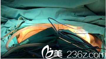 韓國(guó)GOOD LINE崔德浩整形外科案例