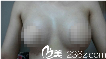 韓國(guó)GOOD LINE崔德浩整形外科案例