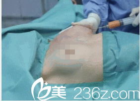 韓國在敦整形外科案例 韓國在敦整形外科案例