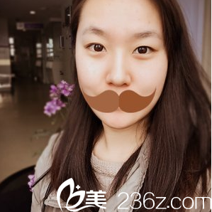 閆品行切開(kāi)雙眼皮+開(kāi)內(nèi)眼角術(shù)術(shù)前照 閆品行切開(kāi)雙眼皮+開(kāi)內(nèi)眼角術(shù)術(shù)前照