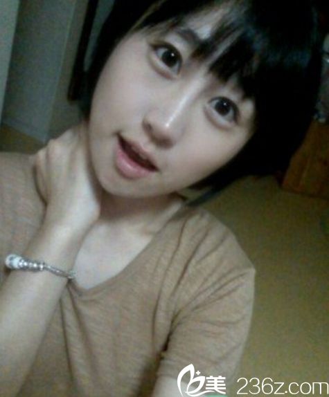 那木下頜角整形怎么樣