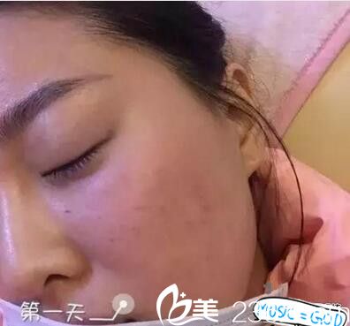 南陽艾美水光注射天 南陽艾美水光注射天