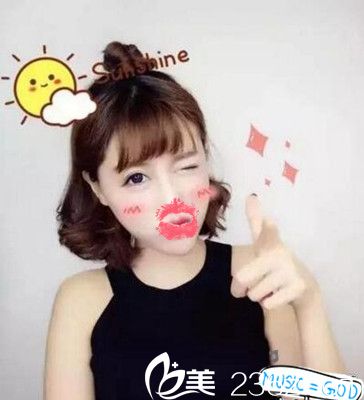 南陽艾美水光注射后7天 南陽艾美水光注射后7天