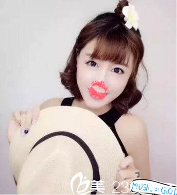 南陽艾美水光注射術(shù)后效果 南陽艾美水光注射術(shù)后效果