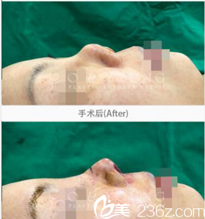 韓國(guó)O&YOUNG整形外科案例 韓國(guó)O&YOUNG整形外科案例