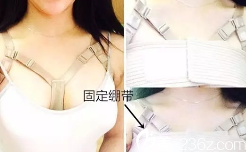 韓國jk整形外科醫(yī)院做隆胸手術(shù)真人案例2 韓國jk整形外科醫(yī)院做隆胸手術(shù)真人案例2