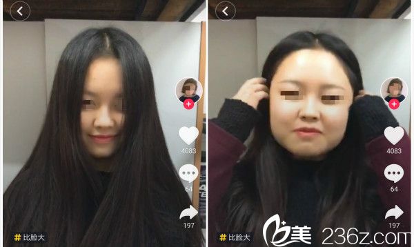 臉大用頭發(fā)遮，鼻子丑怎么辦