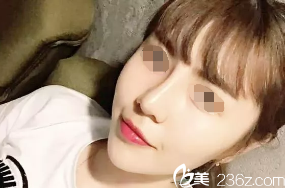 美女更精致，韓國(guó)will醫(yī)院一個(gè)鼻綜合美出新高度