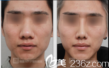 韓國MVP整形外科醫(yī)院案例 韓國MVP整形外科醫(yī)院案例