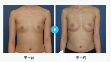 韓國MIGO整形外科醫(yī)院案例 韓國MIGO整形外科醫(yī)院案例