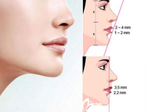 韓國4月31日完美下巴的標(biāo)準(zhǔn)