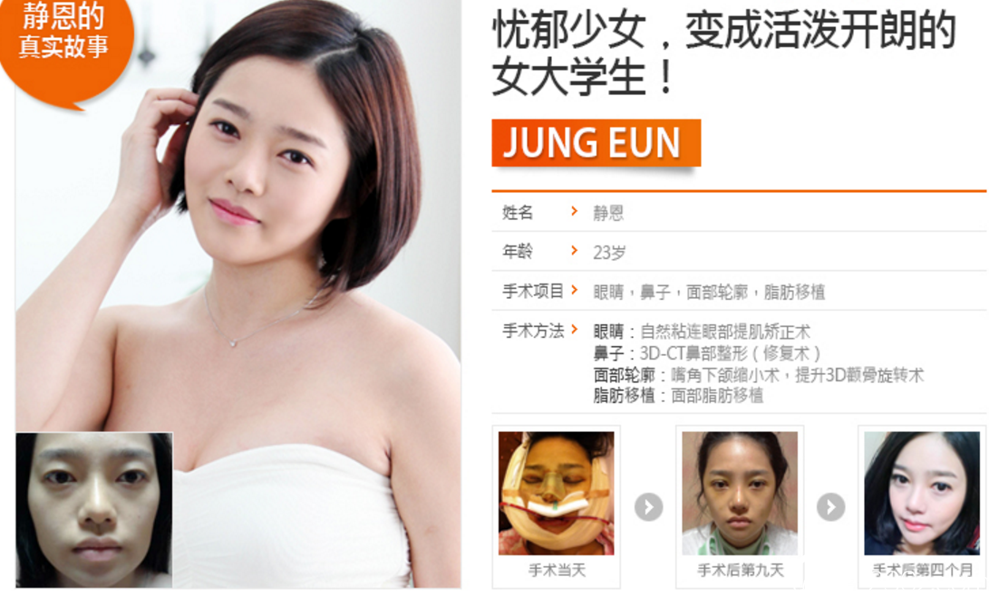 韓國(guó)博朗溫整形外科做鼻子、輪廓好嗎？ 