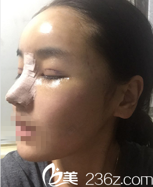 韓國DREAM夢想整形外科醫(yī)院案例 韓國DREAM夢想整形外科醫(yī)院案例