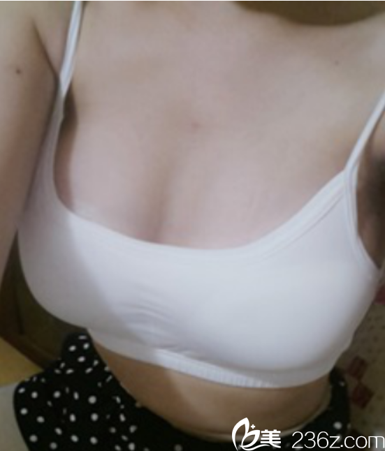 HERSHE整形外科醫(yī)院隆胸