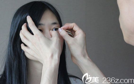 院長親自設(shè)計雙眼皮方案 院長親自設(shè)計雙眼皮方案