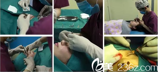 合肥福華醫(yī)療美容醫(yī)院趙章杰工作風(fēng)采 合肥福華醫(yī)療美容醫(yī)院趙章杰工作風(fēng)采