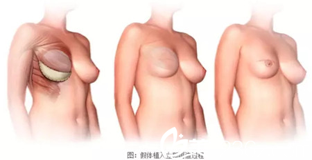 20171225_1514171683543887.png blob.png