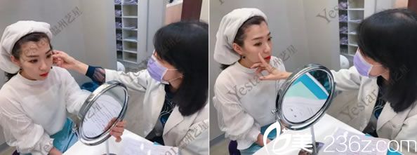 溫州藝星祛斑醫(yī)生面診過程