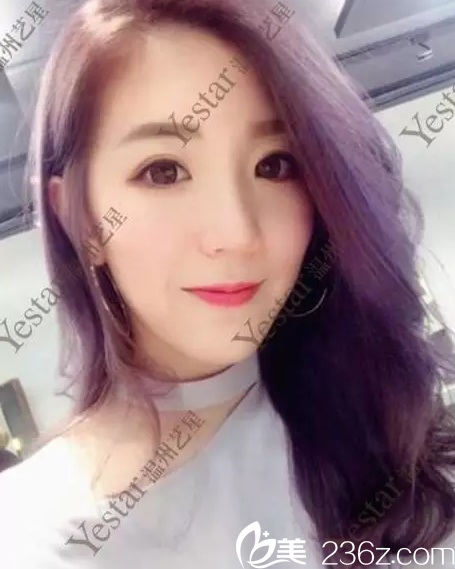 激光祛斑手術(shù)<span style=