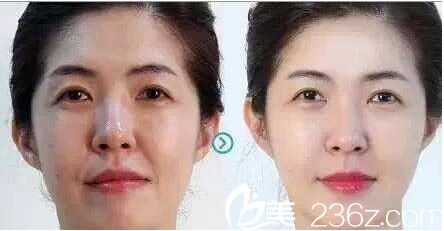 20171225_1514188395978962.jpg 20171225_1514188395978962.jpg