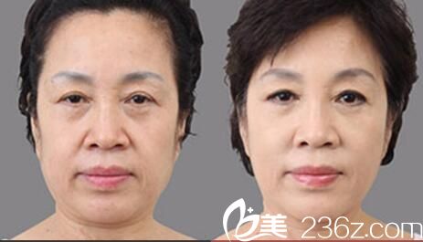   韓國(guó)SHE’S整形外科醫(yī)院金敬昊做美白肌膚效果好不好？美白肌膚真人案例