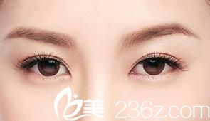 清潭雙眼皮形態(tài)更自然