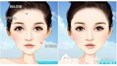 駐馬店美林苑面部填充