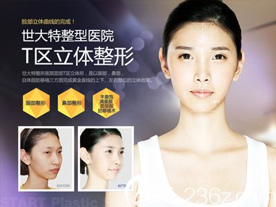 世特大START整形醫(yī)院吳東錫院長的START“T區(qū)立體整形”術(shù)