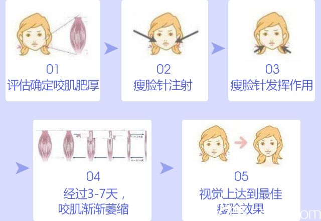 瘦臉除皺瘦臉的過程