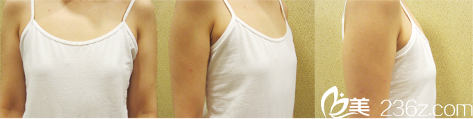 START醫(yī)院真人案例術(shù)前拍照