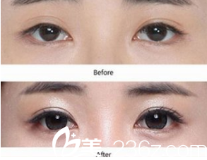 ISTAR整形外科案例 ISTAR整形外科案例