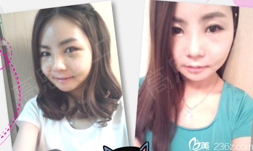 趙胄元院做面部輪廓出名嗎