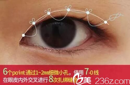 6點(diǎn)定位 雙眼皮洪宗鉉