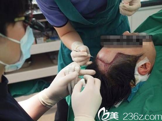 金大溶院長毛發(fā)移植手術(shù)過程 金大溶院長毛發(fā)移植手術(shù)過程