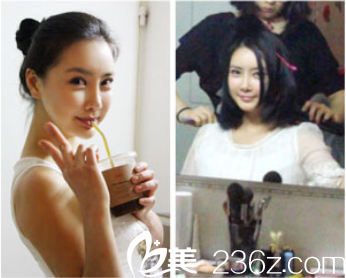 申承翰院長(zhǎng)面部輪廓案例術(shù)后效果 申承翰院長(zhǎng)面部輪廓案例術(shù)后效果