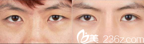 Beauty Line 4U整形外科醫(yī)院案例 Beauty Line 4U整形外科醫(yī)院案例