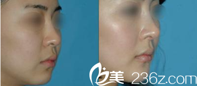 Beauty Line 4U整形外科醫(yī)院案例