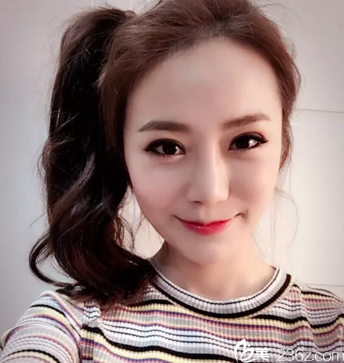 韓國(guó)歌柔飛整形醫(yī)院樸鍾喆雙眼皮<span style=