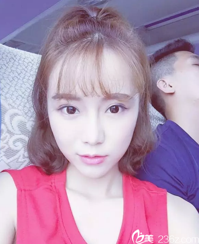 韓國(guó)歌柔飛整形醫(yī)院魯峰一隆鼻