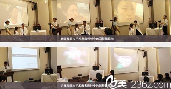 德萊茵整形外科介紹切開(kāi)雙眼皮術(shù)