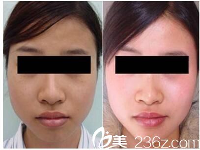 岳主任美容美膚效果怎么樣 岳主任美容美膚效果怎么樣