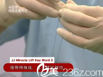 禹政浩院長使用特殊線提拉皺紋 禹政浩院長使用特殊線提拉皺紋