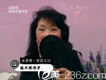 美來可整形醫(yī)院面部提升術(shù) 美來可整形醫(yī)院面部提升術(shù)